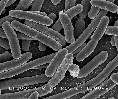 Photo: electron micrograph of Escherichia coli. 